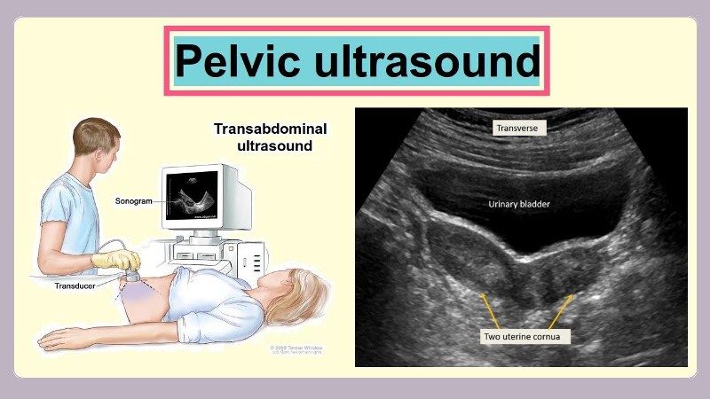 Ultrasonografi Pelvis