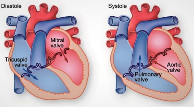 Regurgitasi Katup Pulmonal