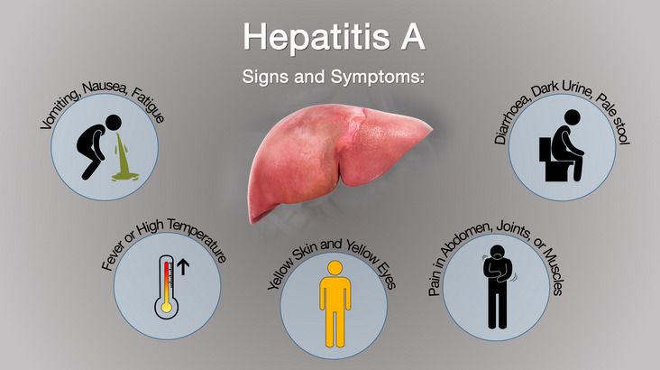 Hepatitis A