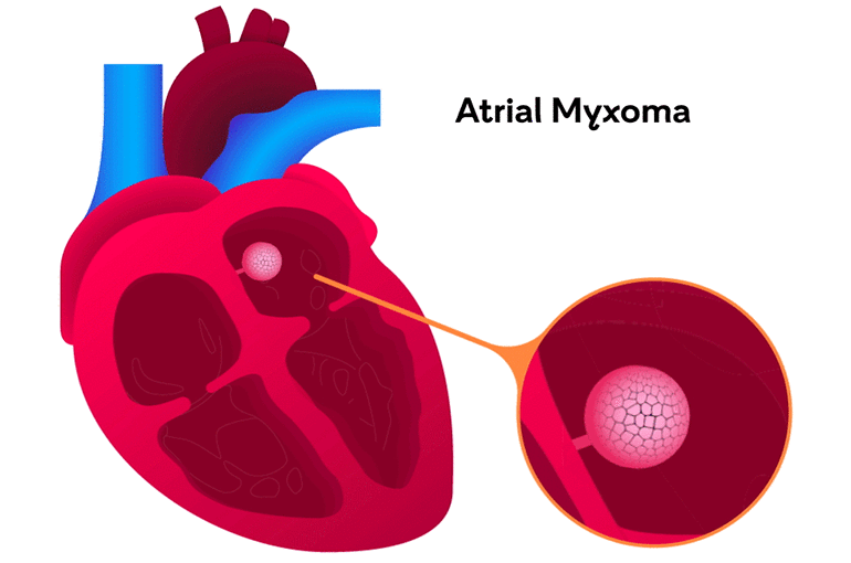 Miksoma