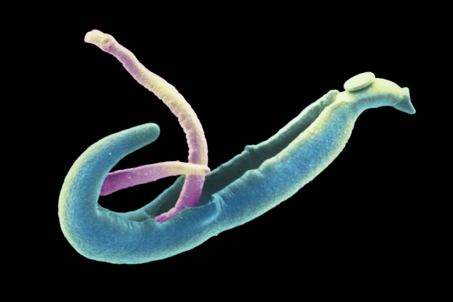 Schistosomiasis