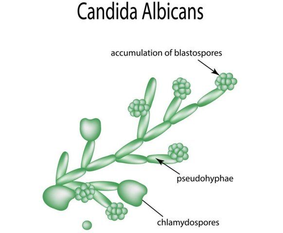 Kandidiasis (Infeksi Jamur)