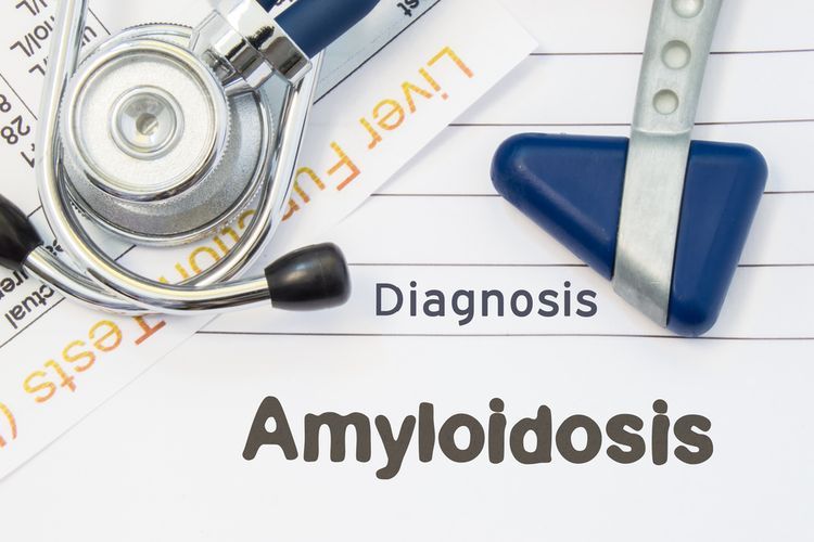 Amiloidosis