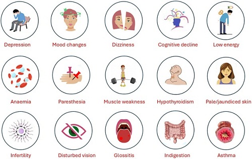 Anemia Karena Kekurangan Vitamin B12