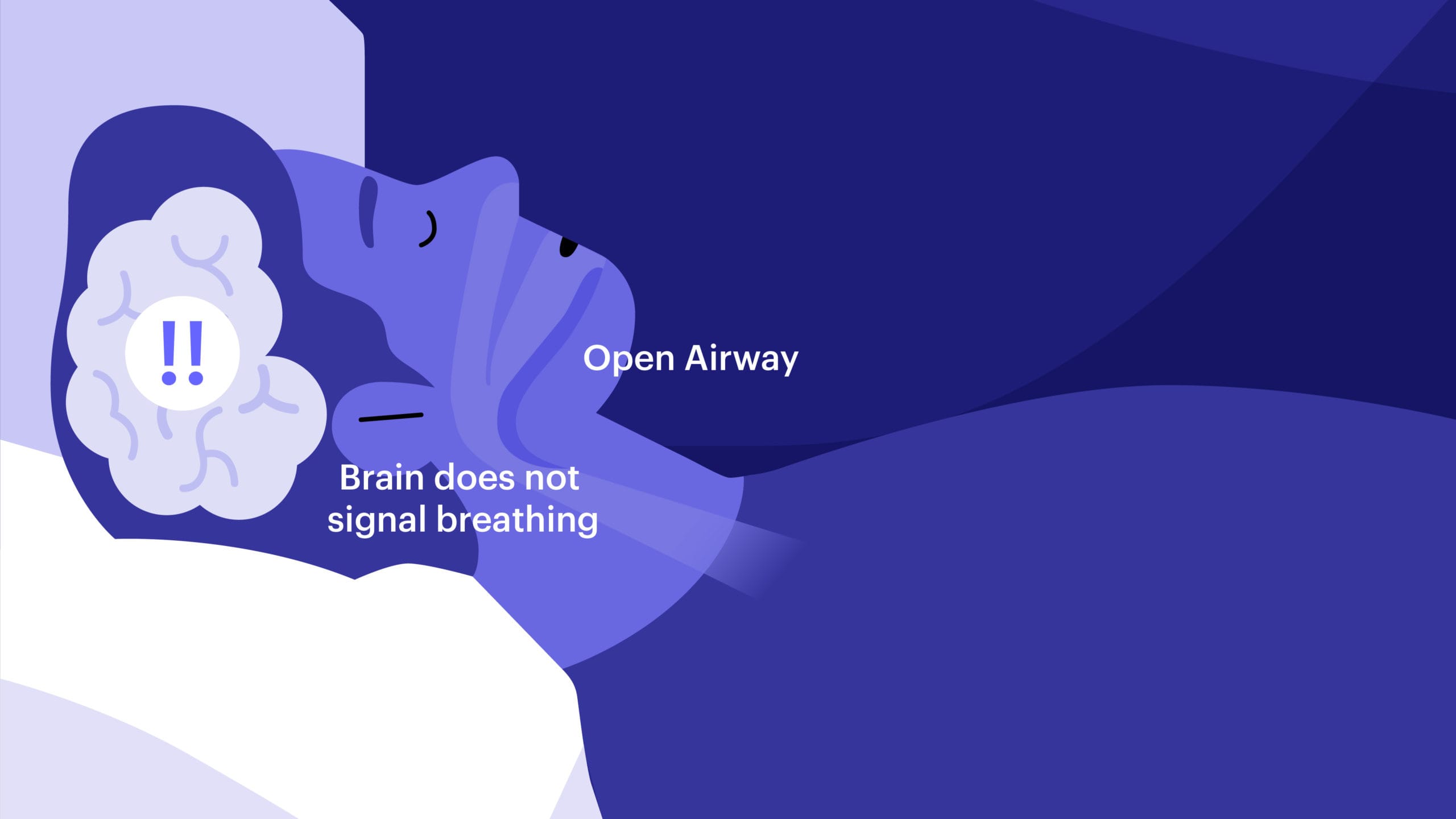 Central Sleep Apnea