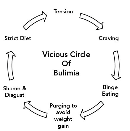 Bulimia Nervosa