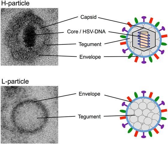 Herpes Genitalis