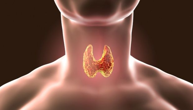 Tiroiditis Pasca Melahirkan