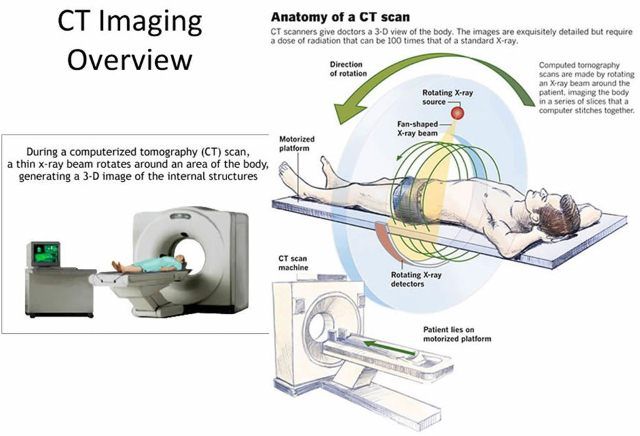 CT Scan Hati dan Saluran Empedu