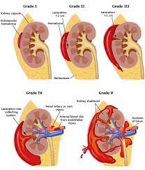Trauma Ginjal