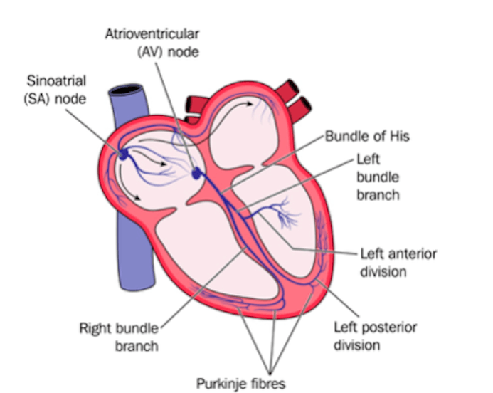 Blokade Cabang Berkas (Bundle Branch Block)