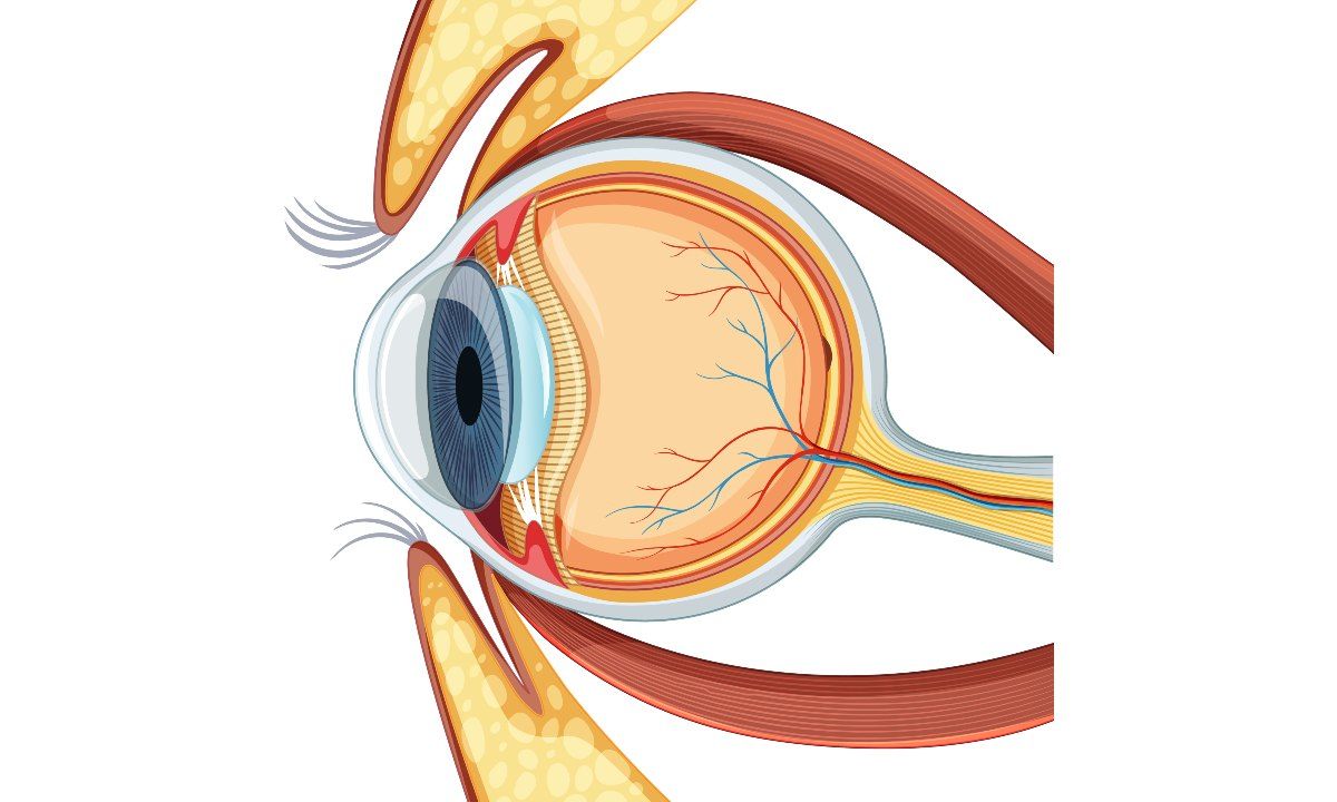 Gangguan Saraf Optik