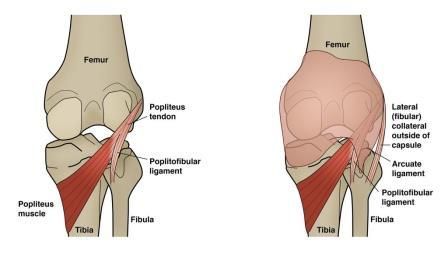 Tendonitis Popliteus