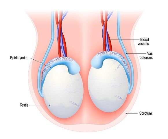 Pembengkakan Testis