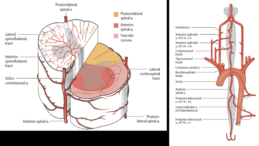 Gangguan Aliran Darah Ke Medula Spinalis