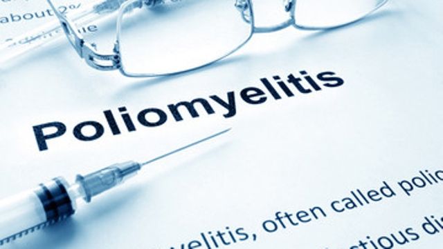 Poliomyelitis