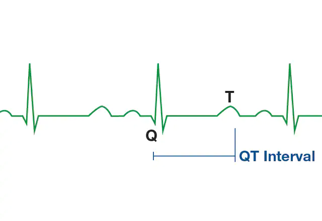 Sindrom Long QT