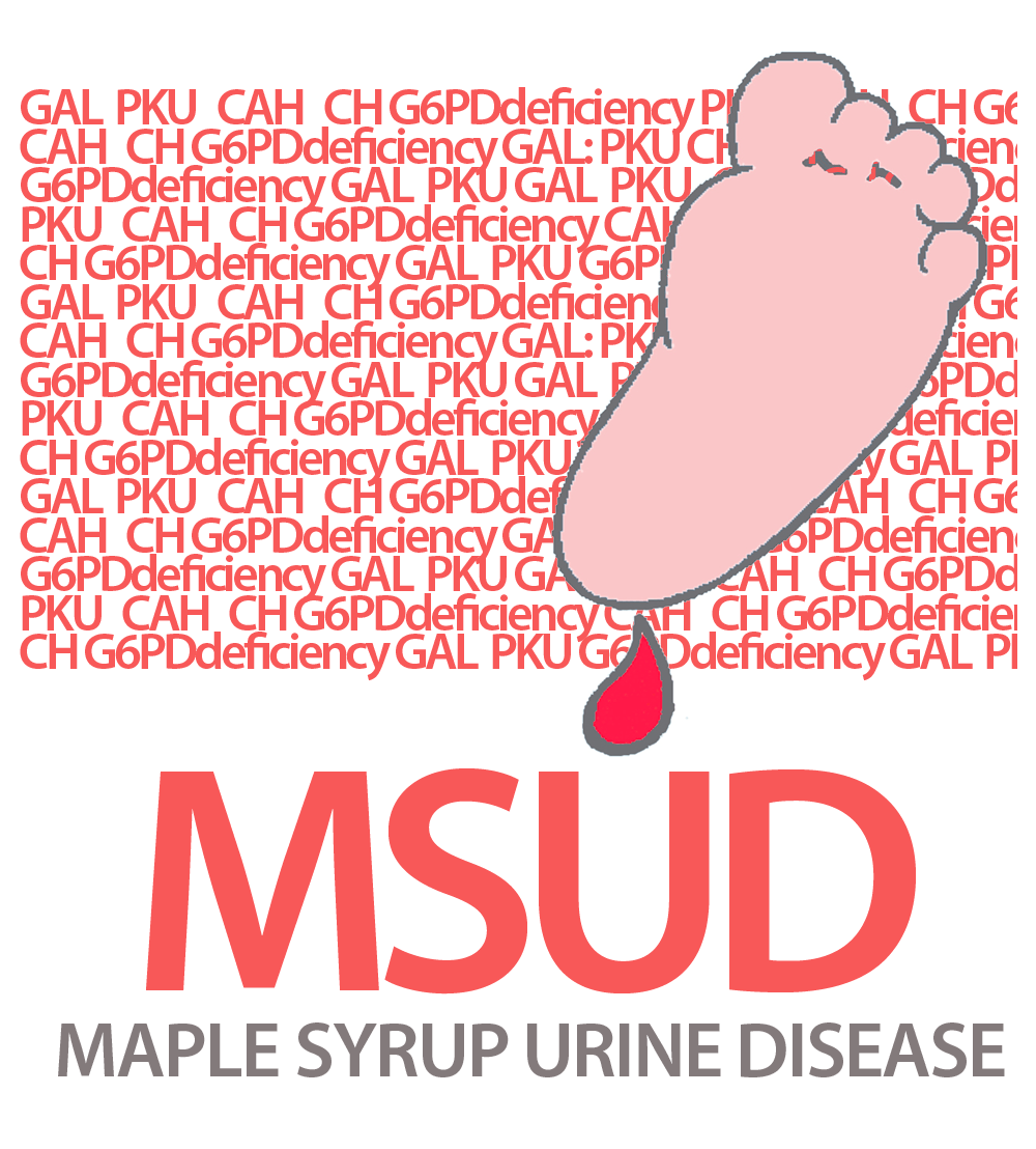 Maple Syrup Urine Disease