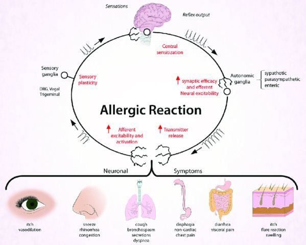 Reaksi Alergi
