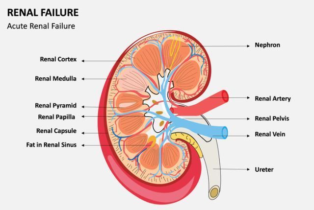 Gagal Ginjal Akut